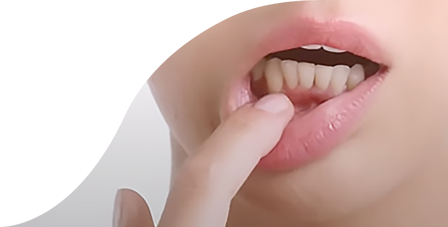 Sensodyne